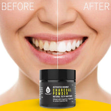 Load image into Gallery viewer, S520 Sonic Toothbrush - Accessories and Activated Coconut Charcoal Powder